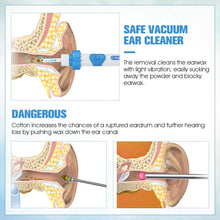 Load image into Gallery viewer, Ear Wax Remover Vacuum Cleaner
